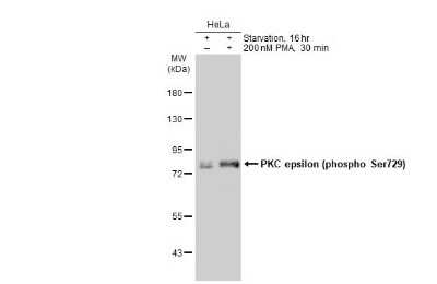 Western Blot: PKC epsilon [p Ser729] Antibody [NBP3-13312]